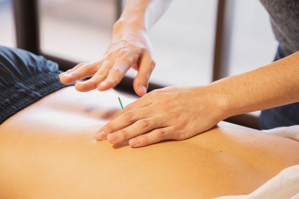 A Guide to Acupuncture in Canberra