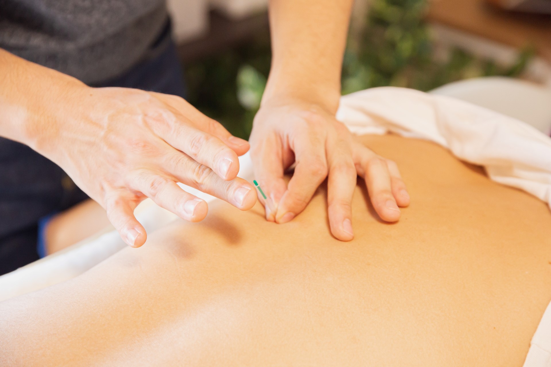 Attributes of a Good Acupuncturist in Canberra